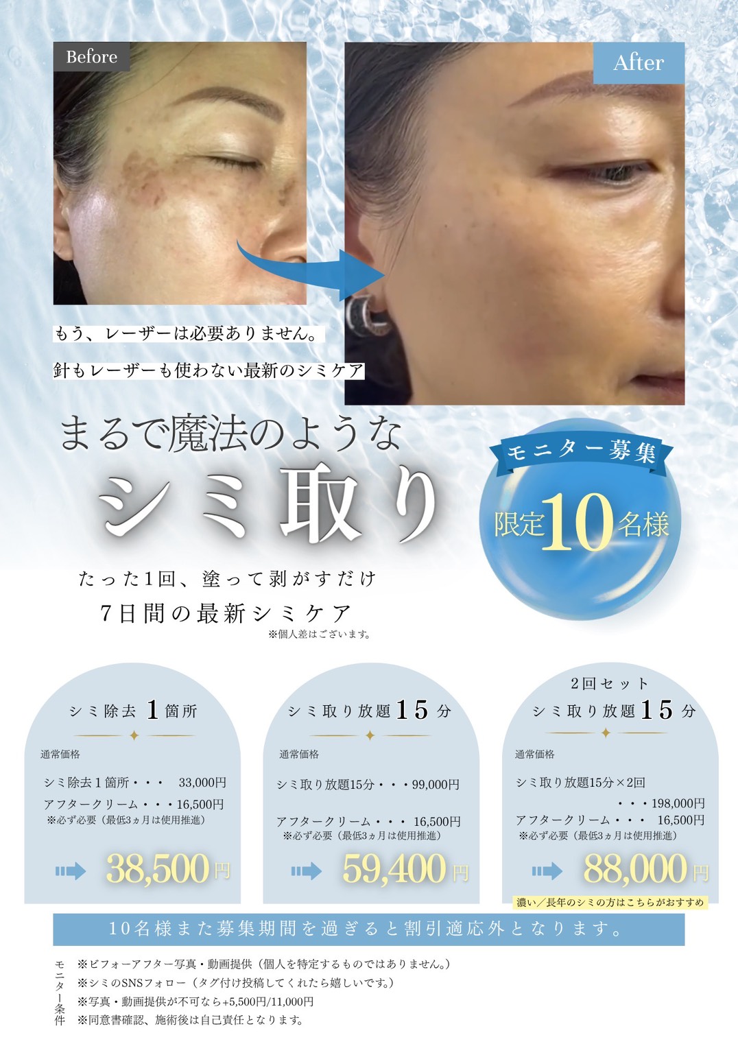 脂肪溶解成分で輪郭と二の腕のぷにぷにとさようなら