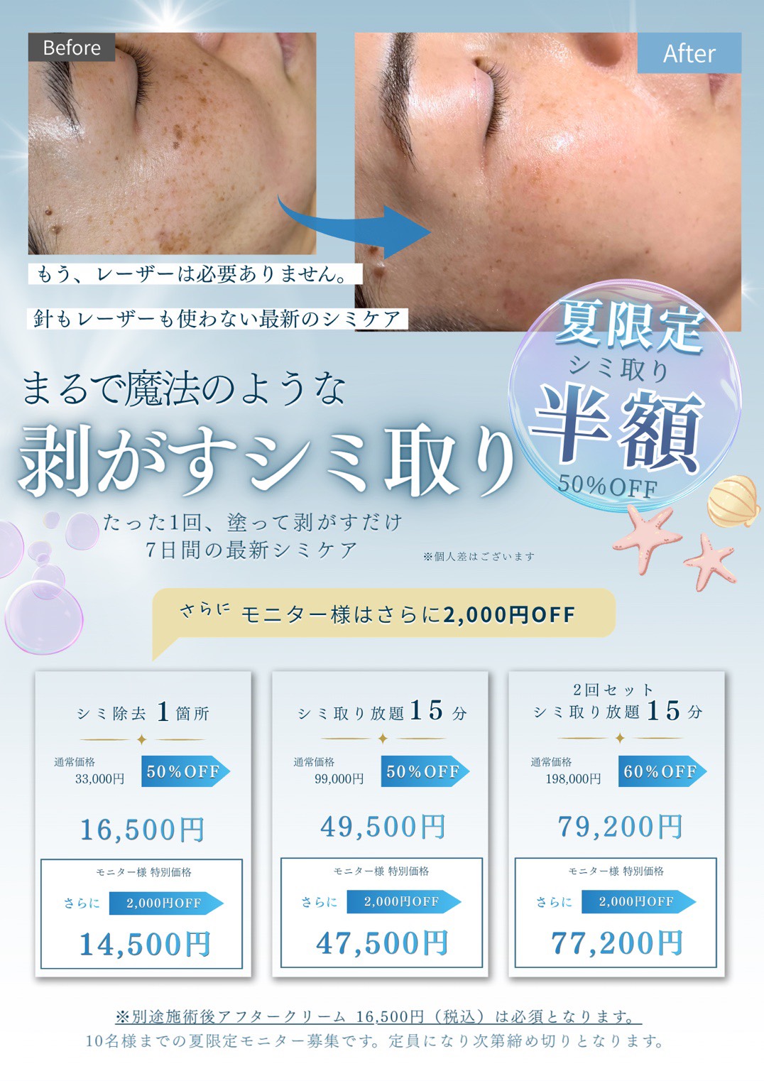 夏限定！！シミ取り半額キャンペーン