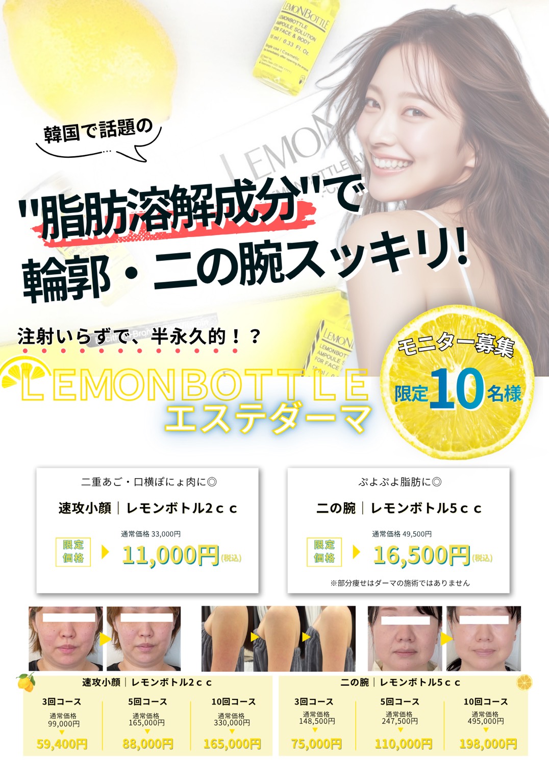 脂肪溶解成分で輪郭と二の腕のぷにぷにとさようなら