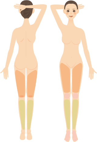 脱毛器画像