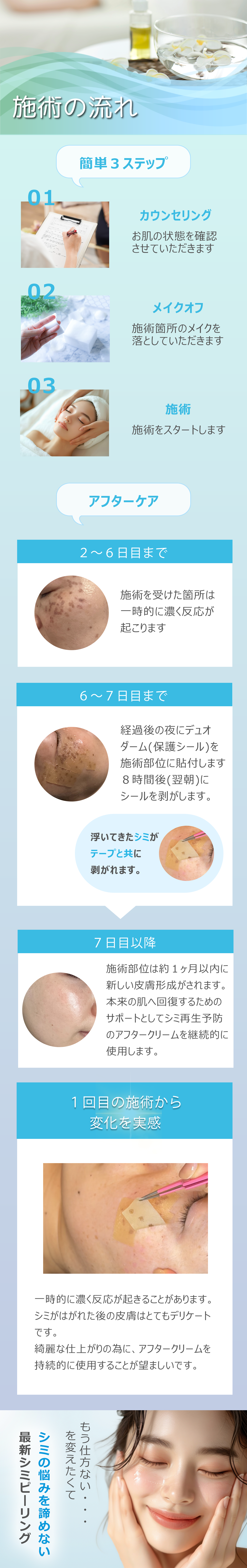 施術の流れと施術後の経過を写真と主にご紹介！料金表は画像表示で確認できます。Q＆A　シミの悩みを諦めない！最新シミピーリング